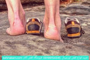 راهکارهای طلایی برای نرم کردن کفش کوهنوردی و جلوگیری از تاول زدن